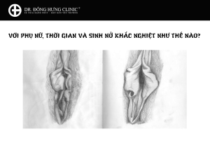 Phẫu thuật cắt môi nhỏ an toàn, không đau, không để lại sẹo