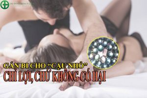 Địa chỉ gắn bi dương vật an toàn, uy tín nhất Hà Nội