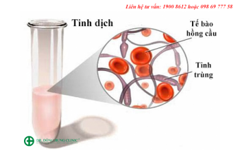 Xuất tinh ra máu: Nguyên nhân do đâu và cách điều trị