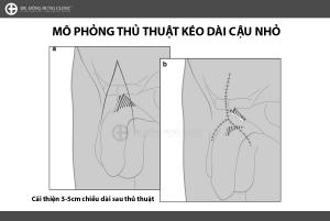 kich-thuoc-binh-thuong-cua-duong-vat