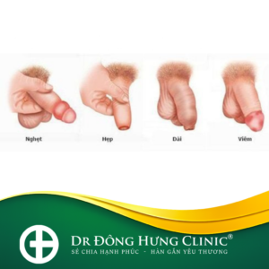 Hẹp bao quy đầu