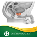 bao quy đầu - hẹp - ngắn - viêm- cắt - sẹo