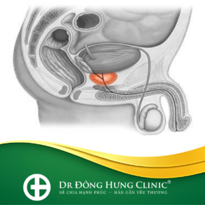bao quy đầu - hẹp - ngắn - viêm- cắt - sẹo