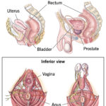 tập kegel - sau sinh - phục hồi - sàn chậu - vùng kín - sinh lý nữ - sinh dục nữ