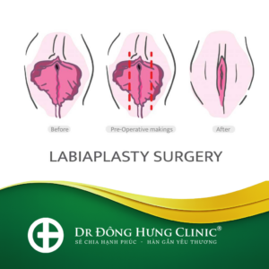 tạo hình môi bé- tạo hình môi lớn -thẩm mỹ- phục hồi- trẻ hóa - cùng kín- cô bé